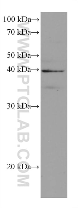 DHODH Mouse Monoclonal Antibody, Proteintech Unconjugated; 150 &mu;L:Antibodies,