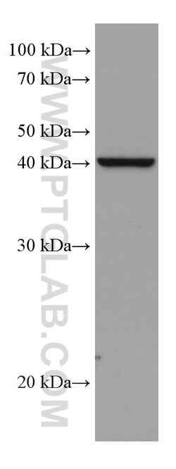 DHODH Mouse Monoclonal Antibody, Proteintech Unconjugated; 150 &mu;L:Antibodies,