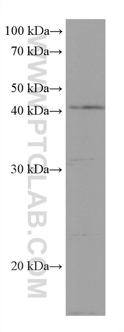 DHODH Mouse Monoclonal Antibody, Proteintech Unconjugated; 150 &mu;L:Antibodies,