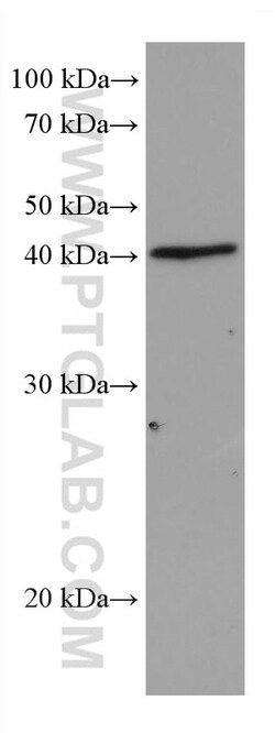 DHODH Mouse Monoclonal Antibody, Proteintech Unconjugated; 150 &mu;L:Antibodies,