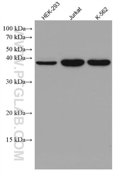 DHPS Mouse Monoclonal Antibody, Proteintech:Anticuerpos:Anticuerpos primarios