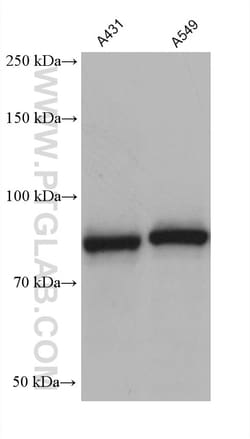 DHX32 Mouse Monoclonal Antibody, Proteintech:Antibodies:Primary Antibodies