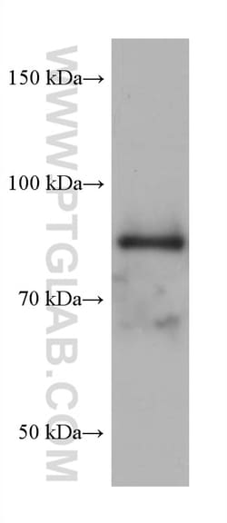 DHX32 Mouse Monoclonal Antibody, Proteintech:Antibodies:Primary Antibodies