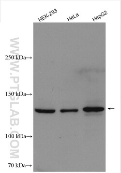 DHX37 Rabbit Polyclonal Antibody, Proteintech:Antibodies:Primary Antibodies