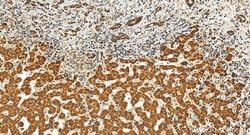 DICER1 Rabbit Polyclonal Antibody, Proteintech Unconjugated; 20 &mu;L:Antibodies,