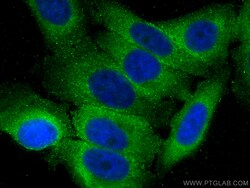 DICER1 Mouse Monoclonal Antibody, Proteintech Unconjugated; 20 &mu;L:Antibodies,