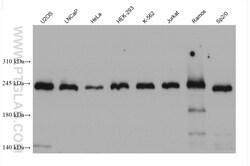 DICER1 Mouse Monoclonal Antibody, Proteintech Unconjugated; 20 &mu;L:Antibodies,