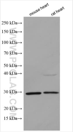 DKK2 Rabbit Polyclonal Antibody, Proteintech:Antibodies:Primary Antibodies