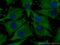 CoraLite Plus 488-conjugated DLC1 Mouse Monoclonal Antibody, Proteintech 100 &mu;L | Buy Online | Proteintech | Fisher Scientific