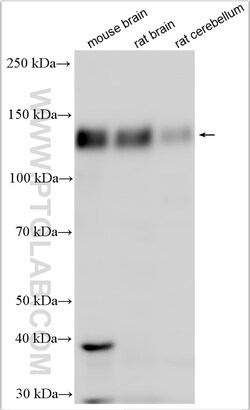 DLGAP1 Rabbit Polyclonal Antibody, Proteintech Unconjugated; 150 &mu;L:Antibodies,