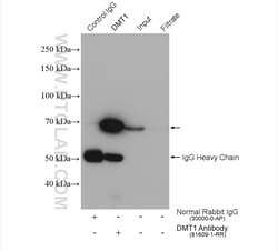 DMT1 Rabbit Recombinant Antibody, Proteintech Unconjugated; 20 &mu;L:Antibodies
