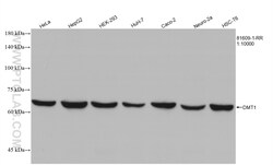 DMT1 Rabbit Recombinant Antibody, Proteintech Unconjugated; 20 &mu;L:Antibodies