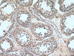 DMXL2 Rabbit Polyclonal Antibody, Proteintech:Antibodies:Primary Antibodies