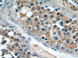 DMXL2 Rabbit Polyclonal Antibody, Proteintech:Antibodies:Primary Antibodies