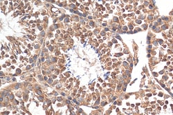 DNAH6 Rabbit Polyclonal Antibody, Proteintech Unconjugated; 150 &mu;L:Antibodies,