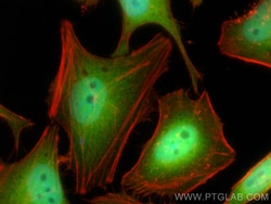 DNAJB1 Rabbit Recombinant Antibody, Proteintech:Antibodies:Primary Antibodies