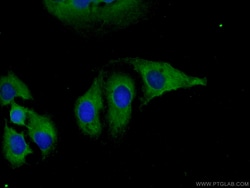 DNAJC18 Rabbit Polyclonal Antibody, Proteintech:Antibodies:Primary Antibodies