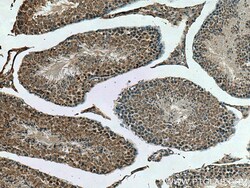 DNAJC18 Rabbit Polyclonal Antibody, Proteintech:Antibodies:Primary Antibodies