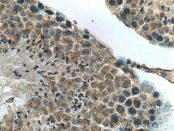 DNAJC18 Rabbit Polyclonal Antibody, Proteintech:Antibodies:Primary Antibodies