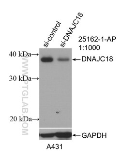 DNAJC18 Rabbit Polyclonal Antibody, Proteintech:Antibodies:Primary Antibodies