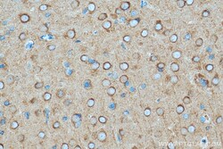 DNM1 Mouse Monoclonal Antibody, Proteintech Unconjugated; 150 &mu;L:Antibodies,