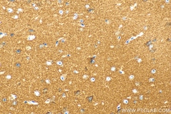 DOC2A Rabbit Polyclonal Antibody, Proteintech:Antibodies:Primary Antibodies