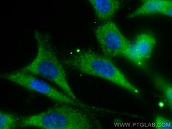 DRP1 (C-terminal) Rabbit Recombinant Antibody, Proteintech Unconjugated;