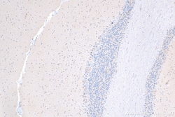DRP1 (C-terminal) Rabbit Recombinant Antibody, Proteintech Unconjugated;
