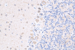 DRP1 (C-terminal) Rabbit Recombinant Antibody, Proteintech Unconjugated;