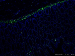 Desmin Mouse Monoclonal Antibody, Proteintech:Antibodies:Primary Antibodies