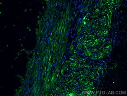 Desmin Mouse Monoclonal Antibody, Proteintech:Antibodies:Primary Antibodies