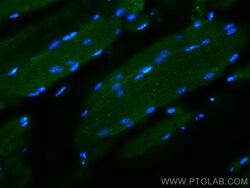 Desmin Mouse Monoclonal Antibody, Proteintech:Antibodies:Primary Antibodies