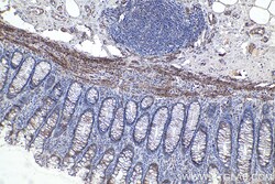 Desmin Mouse Monoclonal Antibody, Proteintech:Antibodies:Primary Antibodies
