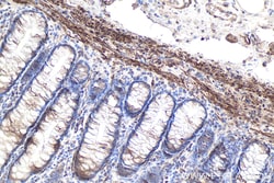 Desmin Mouse Monoclonal Antibody, Proteintech:Antibodies:Primary Antibodies