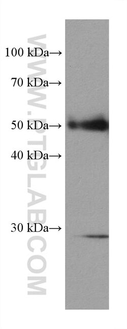 Desmin Mouse Monoclonal Antibody, Proteintech:Antibodies:Primary Antibodies
