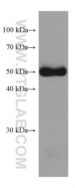 Desmin Mouse Monoclonal Antibody, Proteintech:Antibodies:Primary Antibodies