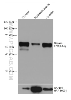 Desmin Mouse Monoclonal Antibody, Proteintech:Antibodies:Primary Antibodies