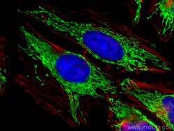 ECHS1 Rabbit Recombinant Antibody, Proteintech:Antibodies:Primary Antibodies