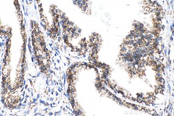 ECHS1 Rabbit Recombinant Antibody, Proteintech:Antibodies:Primary Antibodies