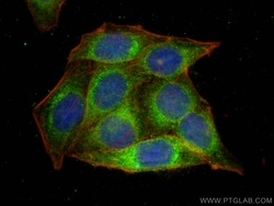 EEF1A1 Rabbit Recombinant Antibody, Proteintech:Antibodies:Primary Antibodies