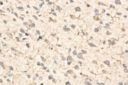 EEF1A1 Rabbit Recombinant Antibody, Proteintech:Antibodies:Primary Antibodies