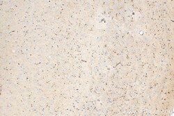 ENO1 Rabbit Recombinant Antibody, Proteintech Unconjugated; 20 &mu;L:Antibodies,