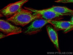 FIS1 Rabbit Recombinant Antibody, Proteintech:Antibodies:Primary Antibodies
