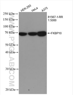 FKBP10/FKBP65 Rabbit Recombinant Antibody, Proteintech:Antibodies:Primary
