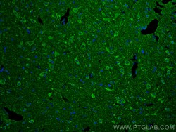 G3BP1 Rabbit Recombinant Antibody, Proteintech:Antibodies:Primary Antibodies