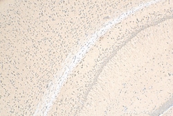 G3BP1 Rabbit Recombinant Antibody, Proteintech:Antibodies:Primary Antibodies