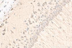 G3BP1 Rabbit Recombinant Antibody, Proteintech