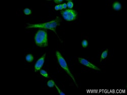 GADD34 Rabbit Recombinant Antibody, Proteintech:Antibodies:Primary Antibodies