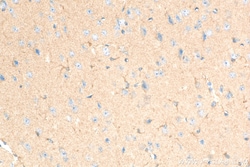 GCLM Rabbit Recombinant Antibody, Proteintech:Antibodies:Primary Antibodies