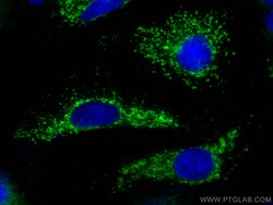KGA/GAC Rabbit Recombinant Antibody, Proteintech:Antibodies:Primary Antibodies